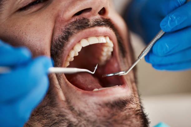 Best Emergency Treatment for Dental Infections or Abscesses in Sandoval, IL