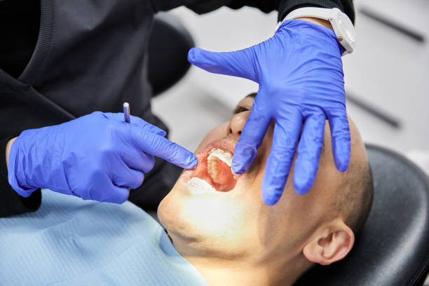 Best After-Hours Dental Trauma Care in Sandoval, IL