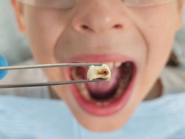 Best Pediatric Emergency Dentist in Sandoval, IL